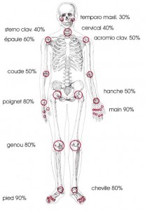 Articulations touchées par la polyarthrite rhumatoïde