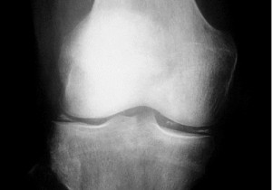 Une radiographie